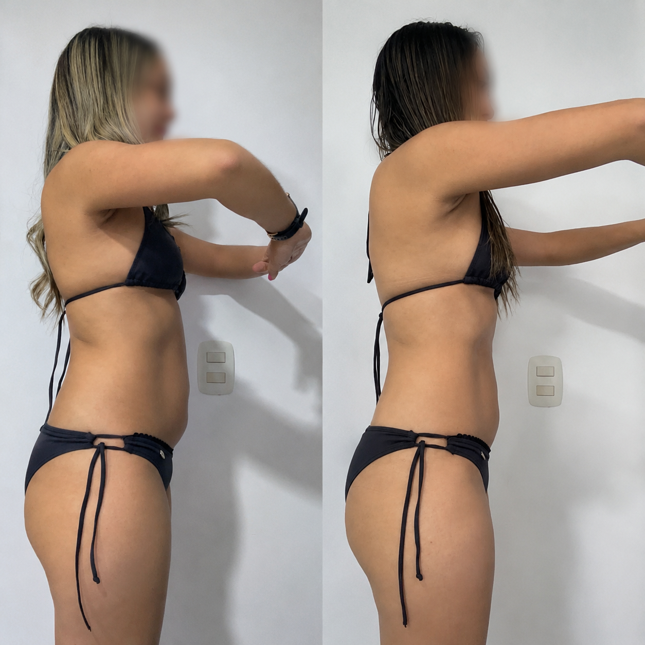 Antes y después